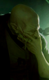 Singed.