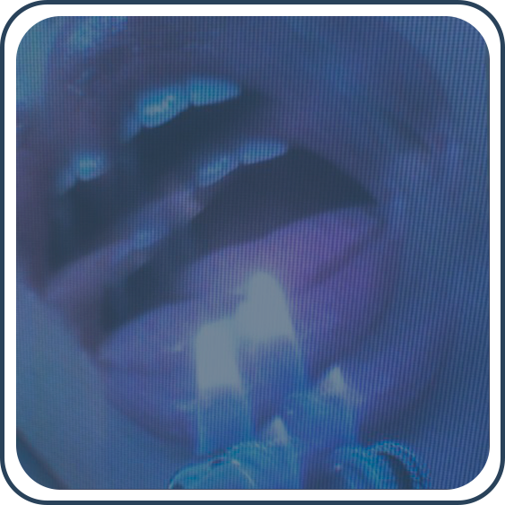 𝓮𝓼𝓬𝓪𝓻𝓷𝓲𝓸
