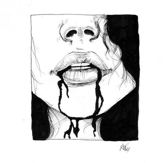 bloodletting